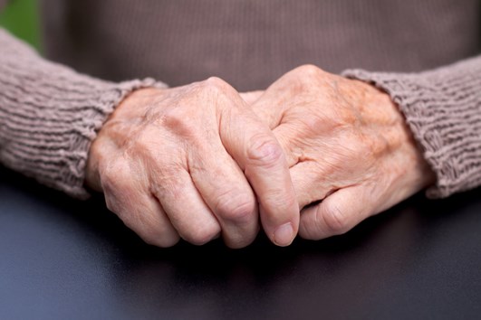 Elderly woman with arthritis